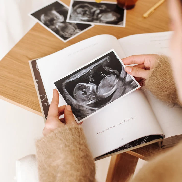 Het begin van jouw leven – Livre de grossesse et de bébé tout-en-un de 0 à 1 an – Birth Lines